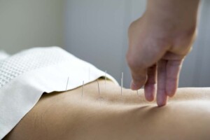 Can an Acupuncturist Practice Acupuncture Using a California LLC?