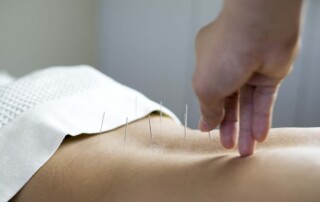 Can an Acupuncturist Practice Acupuncture Using a California LLC?