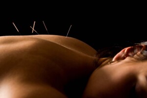 Can a California Professional Acupuncture Corporation Be an S-Corp?