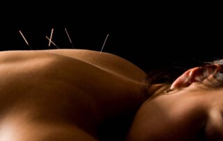 Can a California Professional Acupuncture Corporation Be an S-Corp?