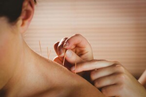 Can I Use a PLLC to Practice Acupuncture in California?