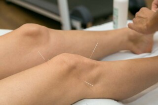 Can an Acupuncturist Practice Using a Foreign Corporation in California?