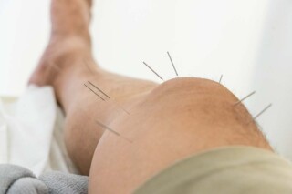 Can Acupuncturists Practice Using a Foreign Professional Corporation in California?