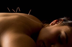 Four Reasons Not to Convert LLC to Professional Acupuncture Corporation in California