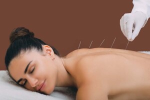 What Liability Protection Does a California Professional Acupuncture Corporation Provide?