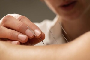 What are the Business Structure Options for Acupuncture Group Practices in California?