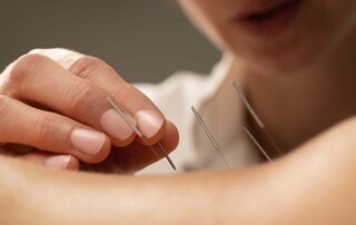 What are the Business Structure Options for Acupuncture Group Practices in California?