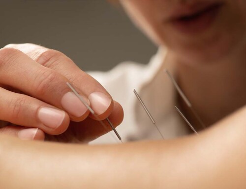 What are the Business Structure Options for Acupuncture Group Practices in California?