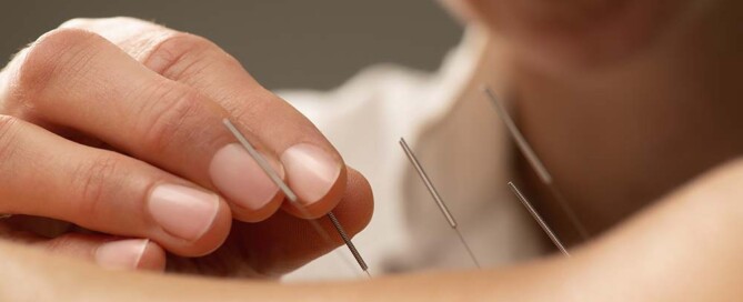 What are the Business Structure Options for Acupuncture Group Practices in California?