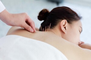 How Long Does It Take to Form a California Professional Acupuncture Corporation?