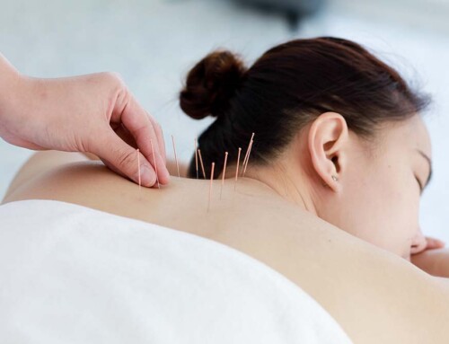 How Long Does It Take to Form a California Professional Acupuncture Corporation?