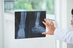 Adequate Capitalization of California Professional Podiatric Medical Corporations