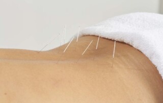 Why is an Acupuncture Practice Not Permitted to Use a Foreign LLC or PLLC in California?