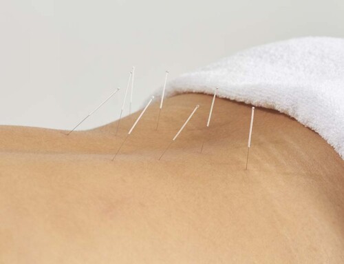 Why is an Acupuncture Practice Not Permitted to Use a Foreign LLC or PLLC in California?