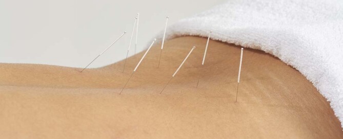 Why is an Acupuncture Practice Not Permitted to Use a Foreign LLC or PLLC in California?