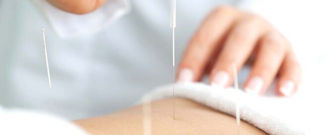 Why is an Acupuncture Practice Not Permitted to Use a Foreign Professional Corporation in California?