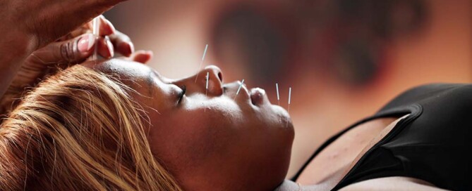 Why Use an Attorney to Form a California Professional Acupuncture Corporation?