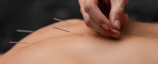 Steps to Take if Not Practicing in a California Professional Acupuncture Corporation