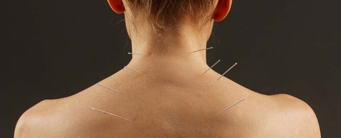 What is a California Professional Acupuncture Corporation?