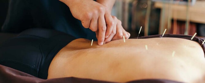 The 8 Requirements for California Professional Acupuncture Corporation Articles of Incorporation