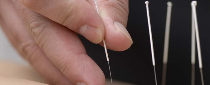 What is an Acupuncture Professional Corporation?