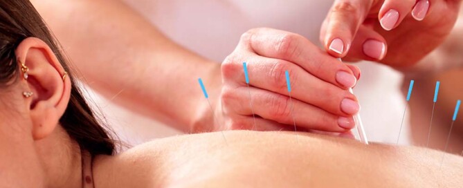 Tax Benefits of California Professional Acupuncture Corporations