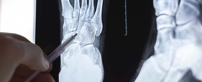 Tax Benefits of California Professional Podiatric Medical Corporations