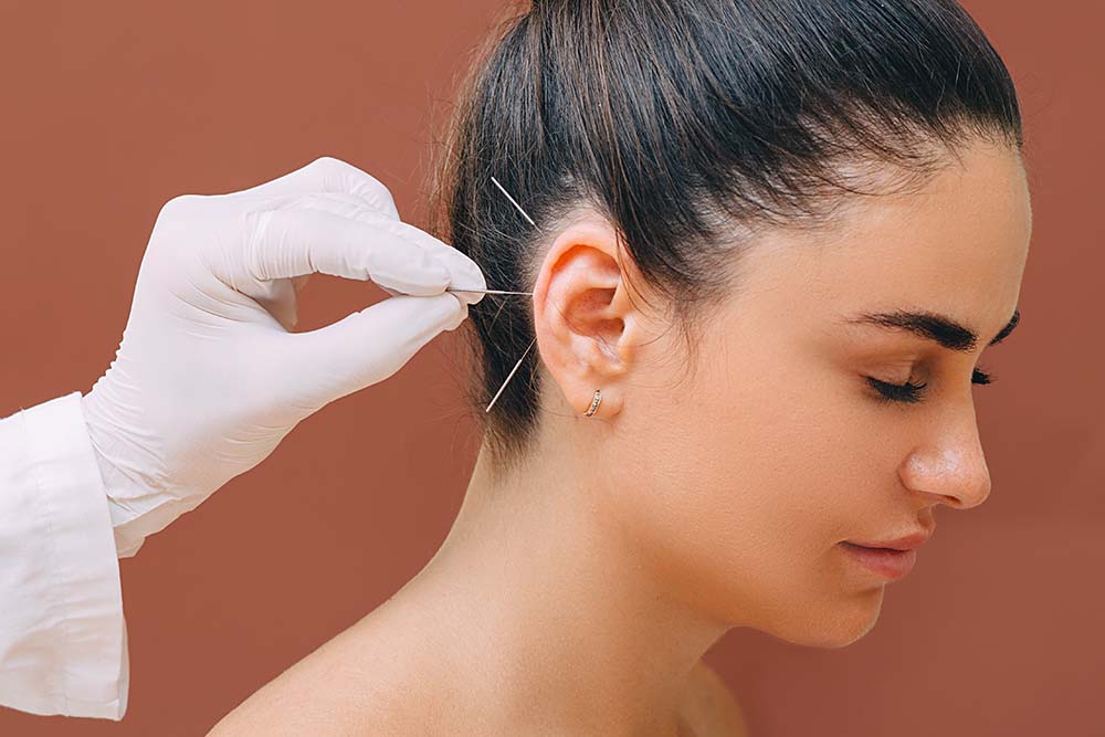 Advantages of California Professional Acupuncture Corporations for Licensed Acupuncturists