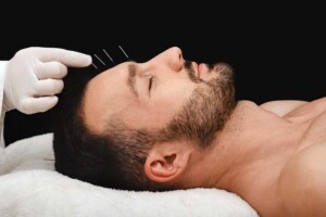 Amending Articles of Incorporation for California Professional Acupuncture Corporations