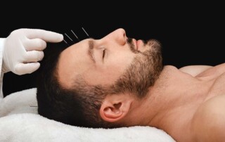 Amending Articles of Incorporation for California Professional Acupuncture Corporations