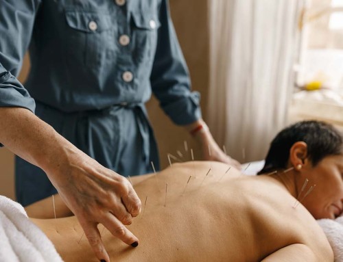 Comparison of Business Structures for Acupuncturists in California