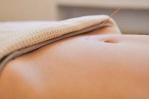Transitioning From a General Stock Corporation to a California Professional Acupuncture Corporation
