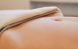 Transitioning From a General Stock Corporation to a California Professional Acupuncture Corporation