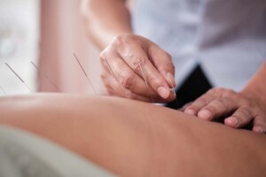 Transitioning From an LLC to a California Professional Acupuncture Corporation