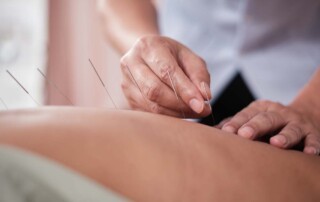 Transitioning From an LLC to a California Professional Acupuncture Corporation