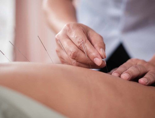 Transitioning From an LLC to a California Professional Acupuncture Corporation