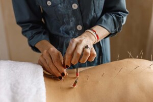 Legal Protections for California Acupuncturists