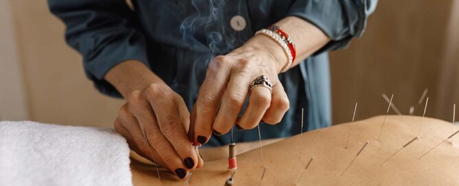 Legal Protections for California Acupuncturists