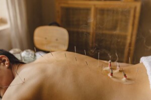 Who Should Be the Registered Agent for My California Professional Acupuncture Corporation?