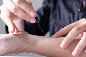 Starting a Private Acupuncture Practice in California