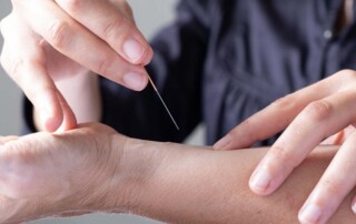 Starting a Private Acupuncture Practice in California