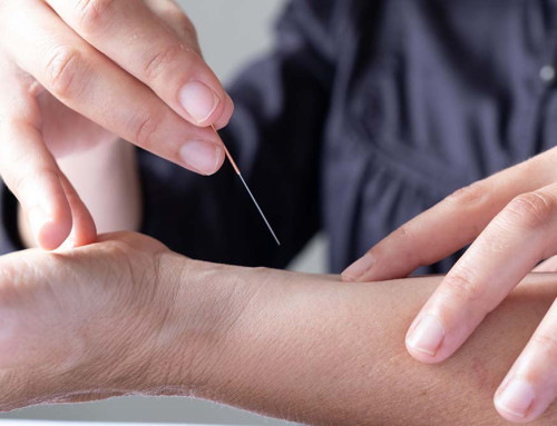 Starting a Private Acupuncture Practice in California