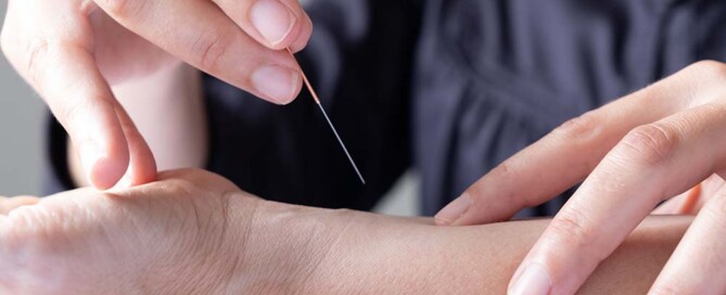 Starting a Private Acupuncture Practice in California